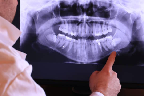 Best Broken or Cracked Tooth Emergency Dentist in Warrenton, MO